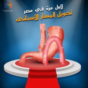 عمليات السمنة الآمنة .. كيف تضمن أمان الجراحة